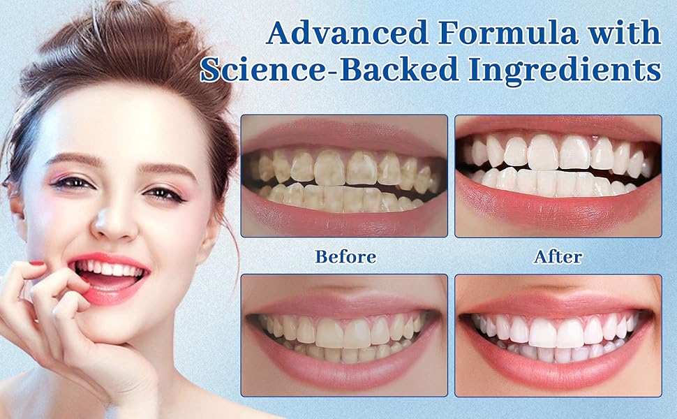 2pcs Nudenta Odontic Repair, Cavity Healing Tooth Armor Liquid, Nano Hydroxyapatite Remineralization Complex for Cavity Repair, Teeth Whitening with Remineralization Drops, Enamel Strengthening 60ml 2 Pack