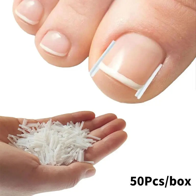 50pcs Ingrown Toenail Correction Tool, Elastic Patch Sticker, Straightening Clip Brace, Pedicure Tool for Ingrown Toe Nails Treatment