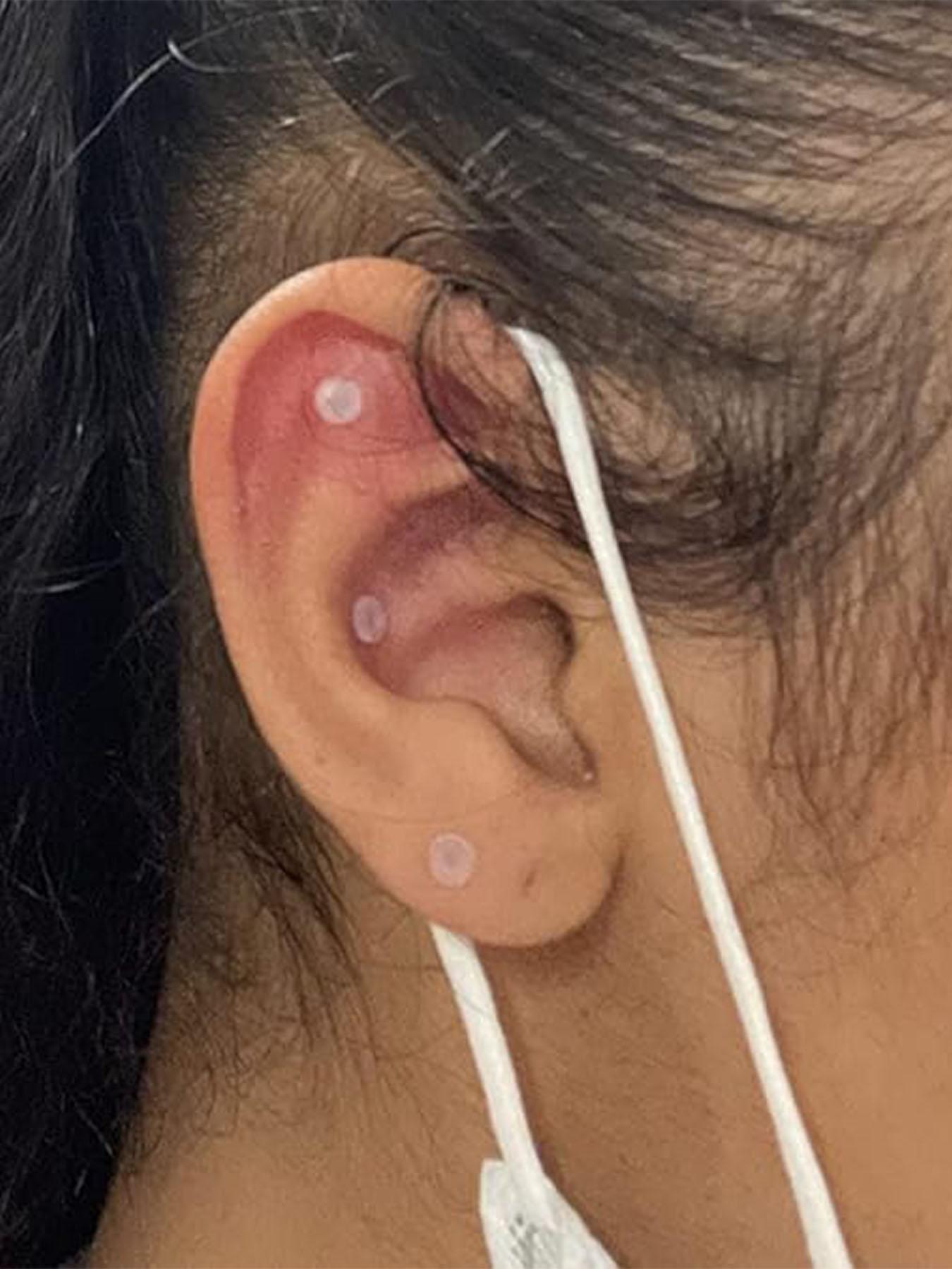 Clear Cartilage Earrings, Plastic Lip Studs, Plastic Piercing Studs Perfect for Surgery, Work, Sport for Women Men, 2024 New Style Body Jewelry for Party and Daily Use