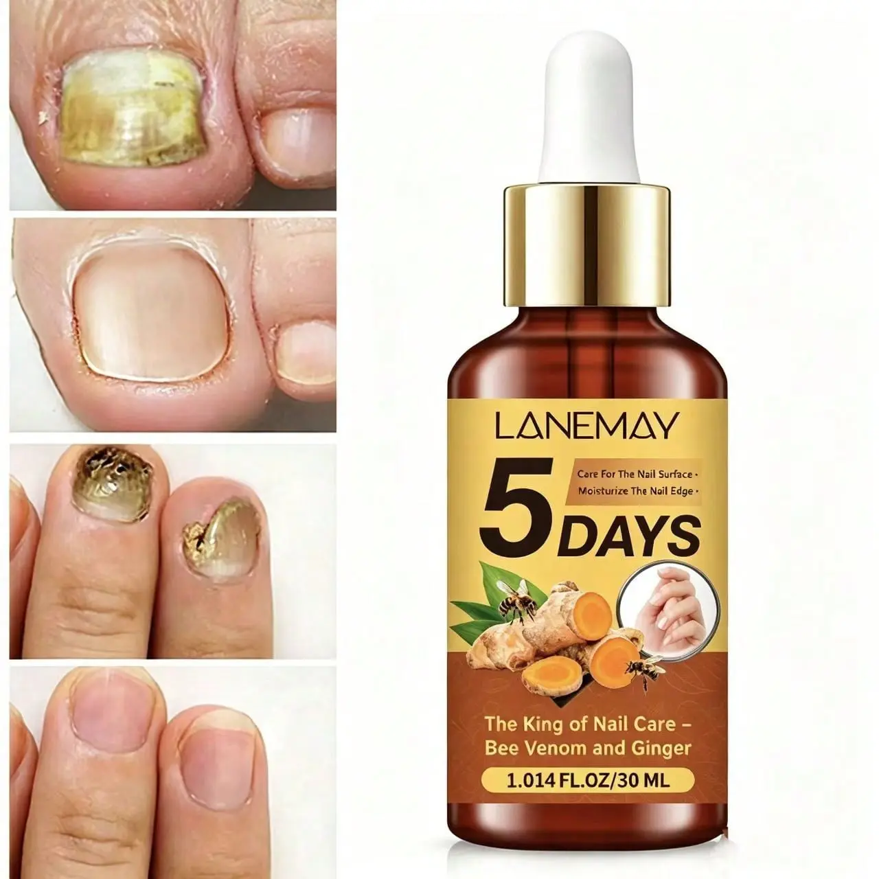 5-Day Renewal Bee Venom Ginger Nail Essence Oil, Cuticle Oil For Nails, Nail Care, Cuticle Nourish, Refreshing Non-Greasy, Gloss Boost, Lightweight Texture, Quick Absorption, 30ML