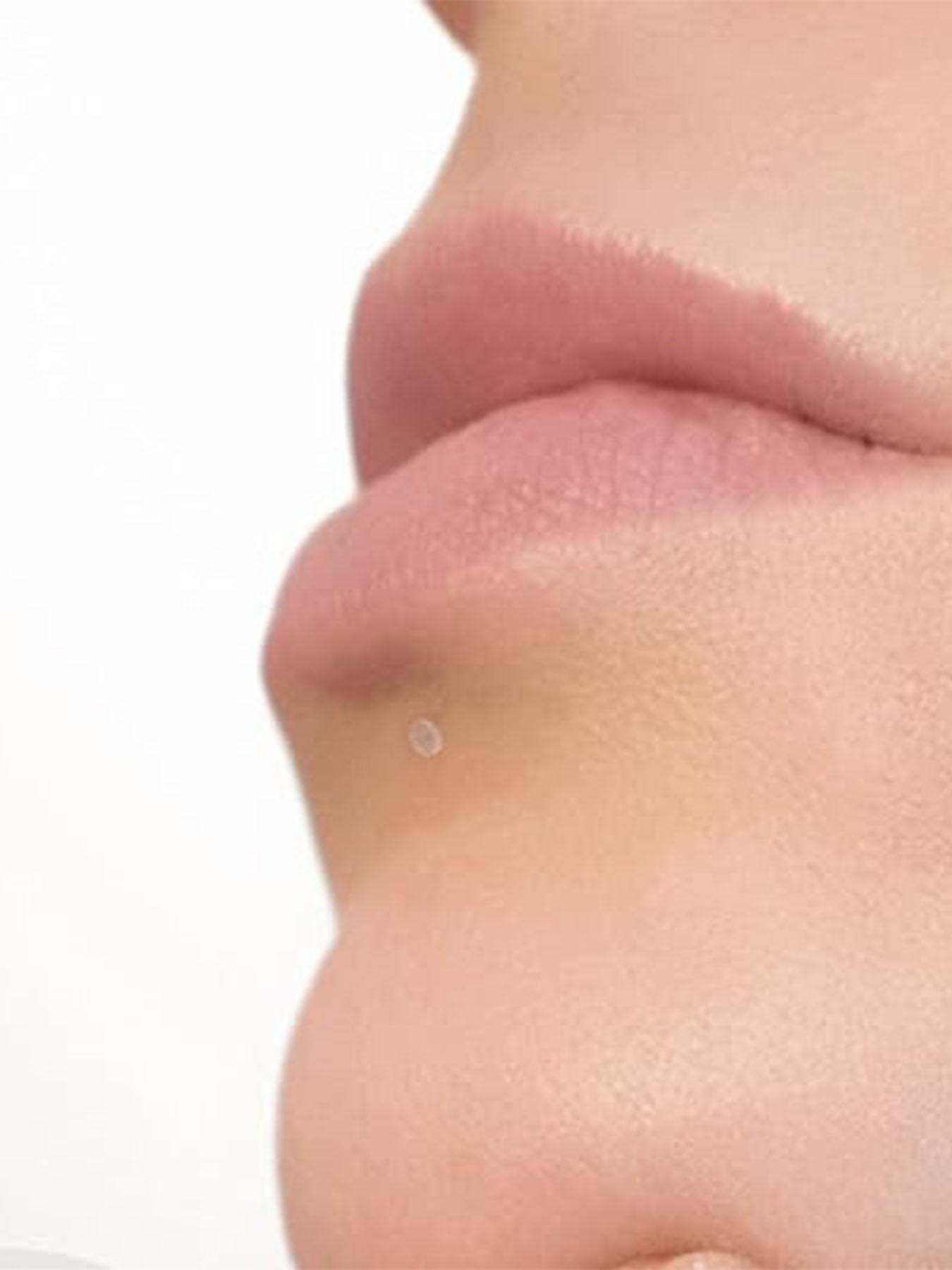 Clear Cartilage Earrings, Plastic Lip Studs, Plastic Piercing Studs Perfect for Surgery, Work, Sport for Women Men, 2024 New Style Body Jewelry for Party and Daily Use