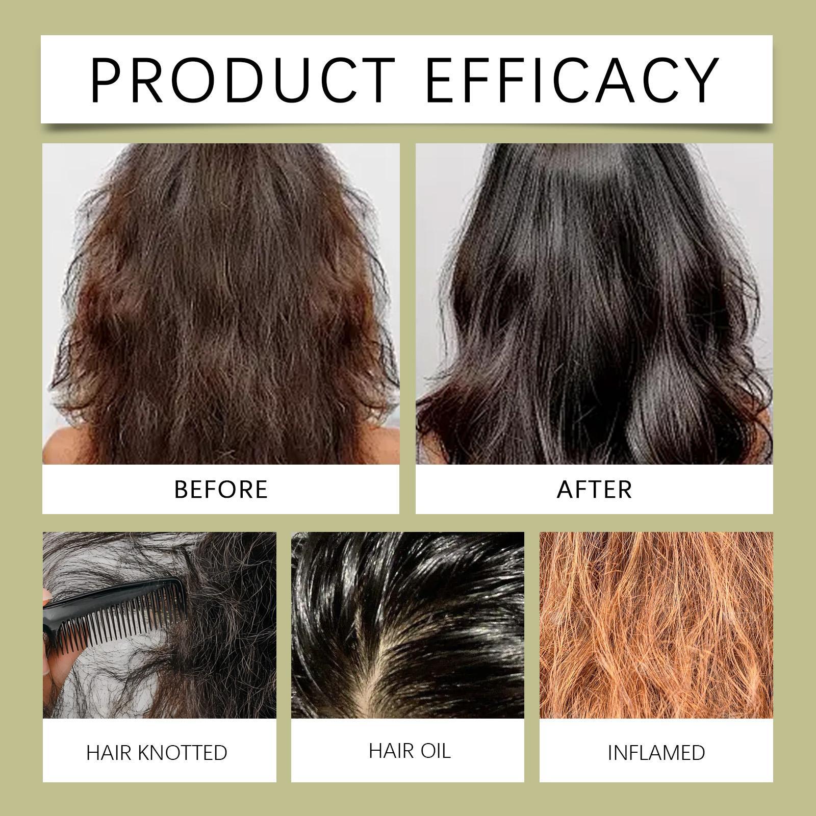 Organic Rosemary Hair Growth Shampoo for Women and Men-Natural Thickening & Strengthening Shampoo with Hydrolyzed Keratin for Thinning Hair & Hair Loss 16.9 fl.oz Organic Rosemary Hair Growth Shampoo for Women and Men-Natural Thickening & Strengthening Shampoo with Hydrolyzed Keratin for Thinning Hair & Hair Loss 16.9 fl.oz