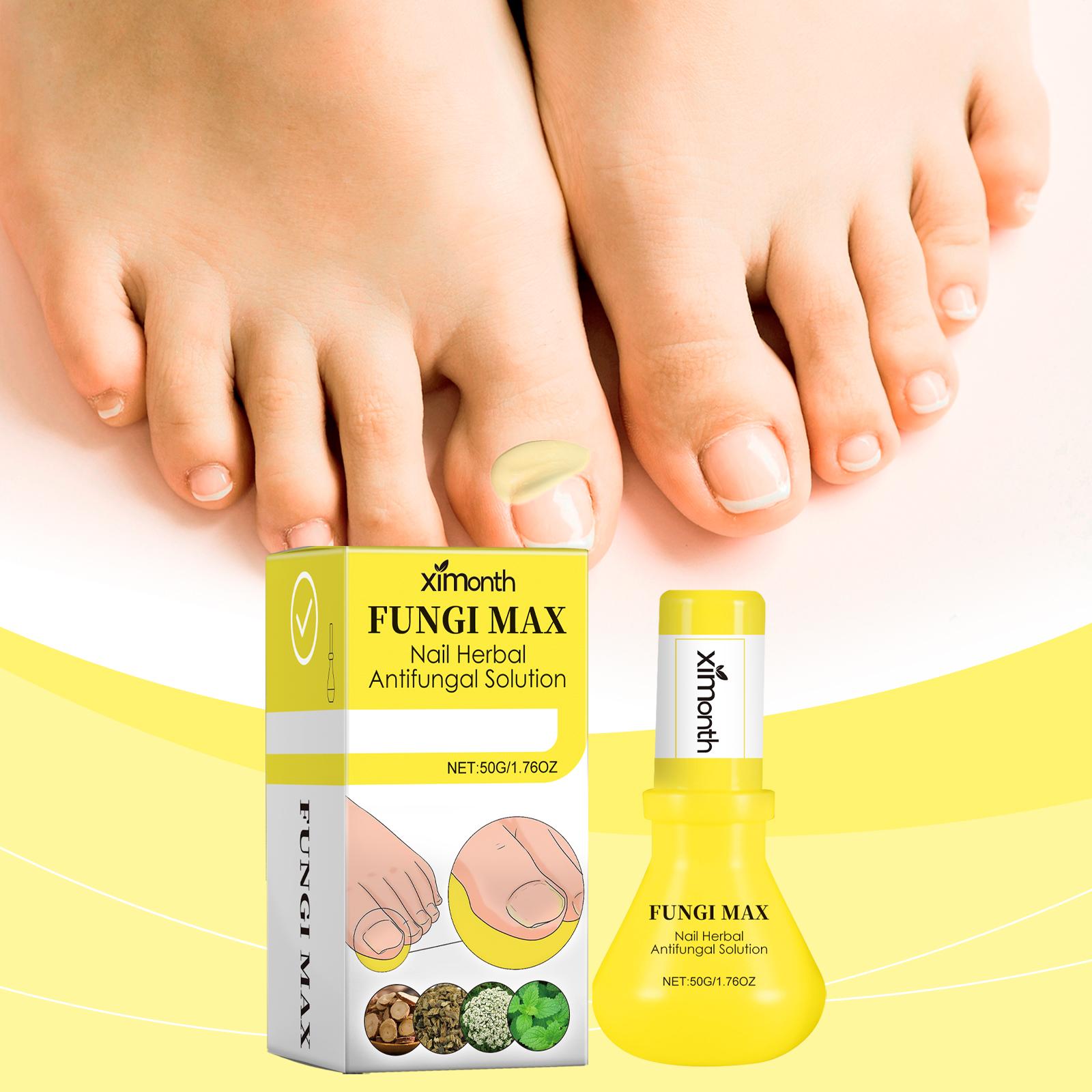 Ximonth Herbal Nail Care Solution Hand, Foot And Nail Cleansing And Repair Bright Nail Thick Toe Care Solution