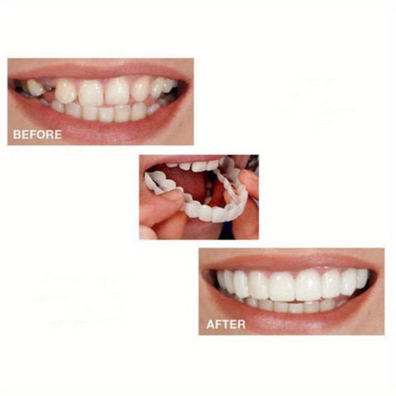 2 Pieces Unisex Comfortable Dental Veneers White Upper and Lower Denture Veneers for Daily Use Create Confident Smile