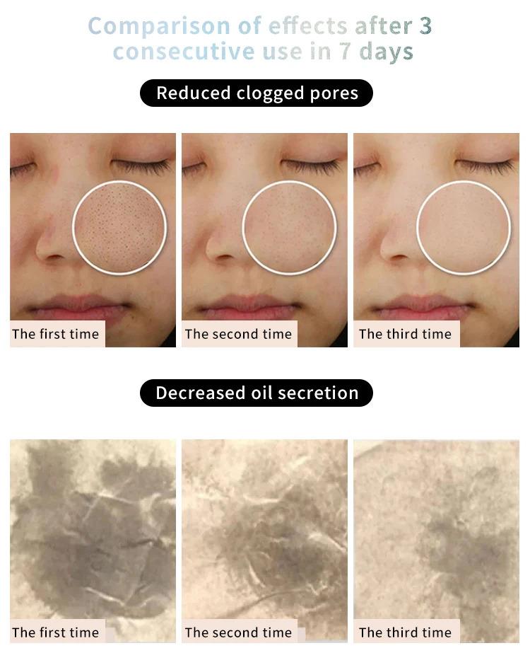 RTS Silicone Spin Skin Scrubber Electric Sonic Facial Brush Cleaner USB Rechargeable Face Cleansing Brush