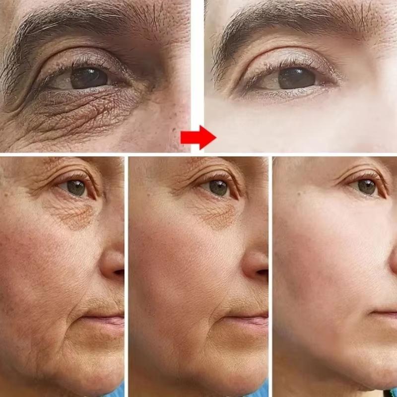 Collagen & Hyaluronic Acid Eye Masks: Firm, Lift, & Erase Wrinkles for Smooth, Youthful Eyes