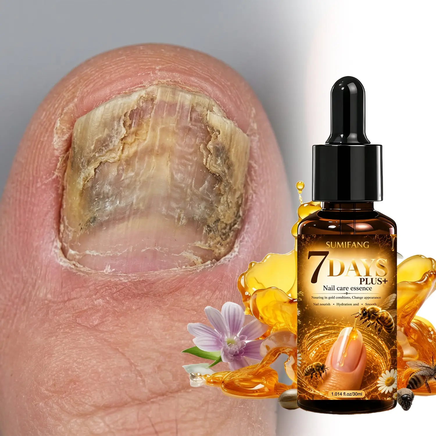 SUMIFANG 7-Day Upgrade Nail Serum 30ml Nail Strengthening Serum – Nail Strengthener, Contains bee venom, jojoba oil, and vitamin E. Hardens and brightens brittle nails within 7 days. Suitable for all nail types, for daily hand and foot care.