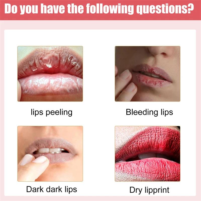 Remove Dark Smoke Lips Pink Fresh Lightening Bleaching Cream Treatment Lip Balm  Moisturizer Nourishing Essence Lips