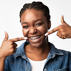 Orthodontic Flossers for Braces, 30 Count (Pack of 2), Ortho Picks for Adults & Kids, Fits Under Arch Wire, Non-Damaging, Encourage Flossing Habits Orthodontic Flossers for Braces, 30 Count (Pack of 2), Ortho Picks for Adults & Kids, Fits Under Arch Wire, Non-Damaging, Encourage Flossing Habits