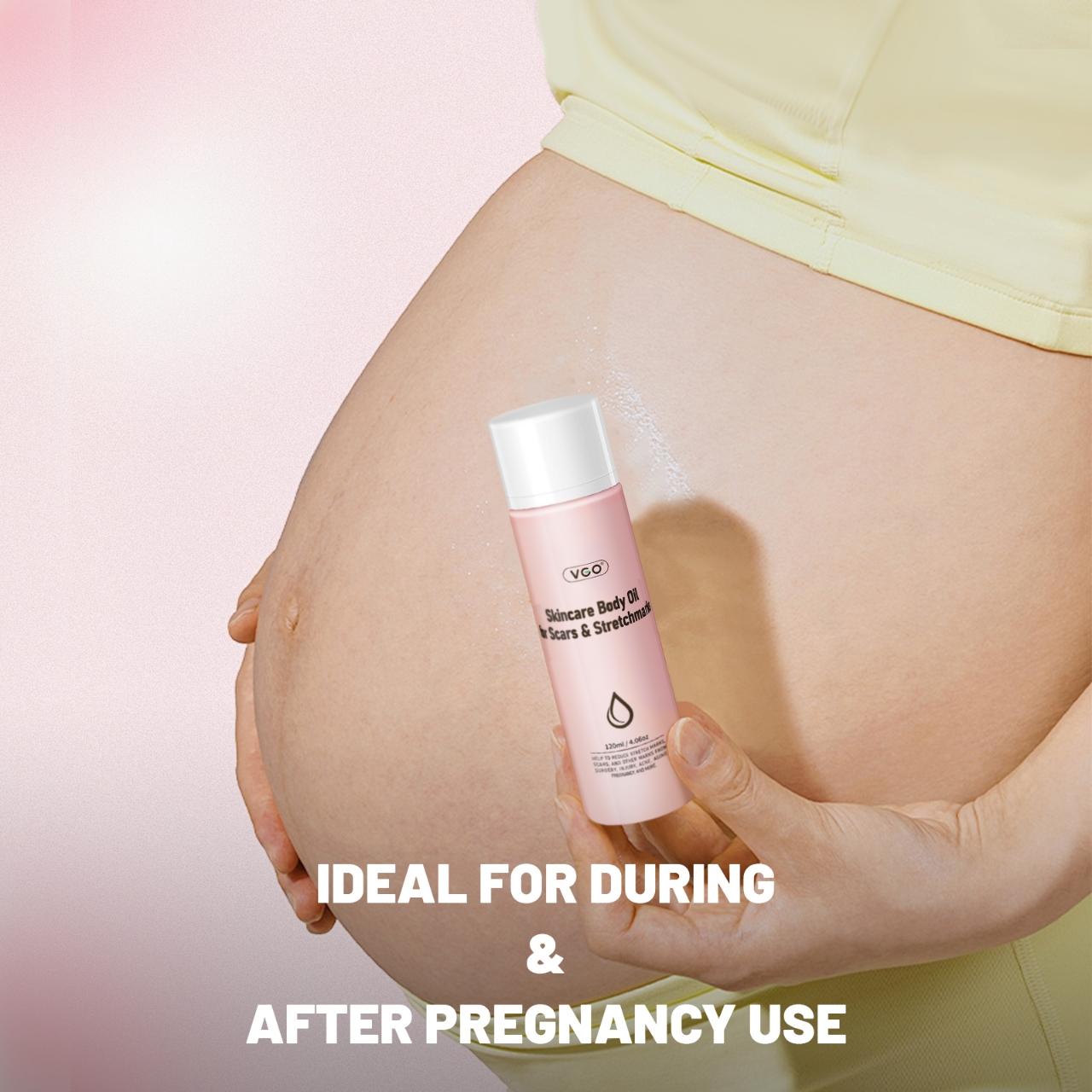 VGO Skincare Body Oil Vitamin A / E Serum for Scars & Stretchmarks, 50/120ml,Dermatologist Recommended, All Skin Types Pink Lavender Chamomile Jojoba Moisturize Olive Plant Radiant Sunflower Cosmetic