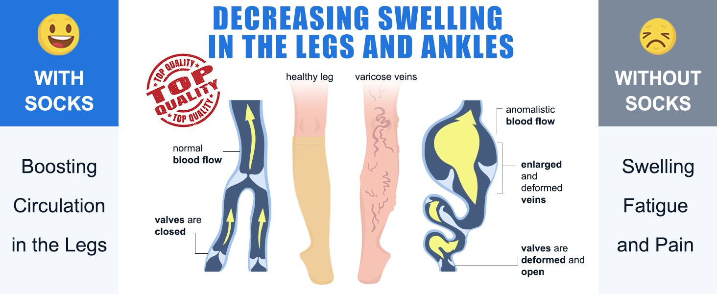 Compression Socks for Women & Men 4 Pairs, Best Support for Nurses Running Travel