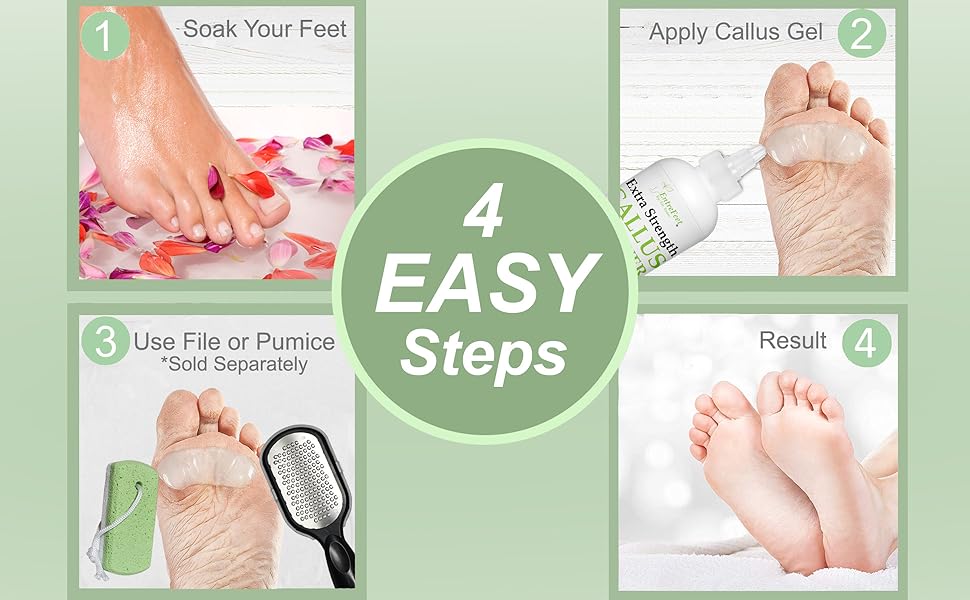 Callus Remover Gel: 8oz Extra Strength with Precision Applicator, Callus Remover for Feet, Foot Callus Remover, Foot Care, Pedicure Tools Supplies, Dead Skin Remover