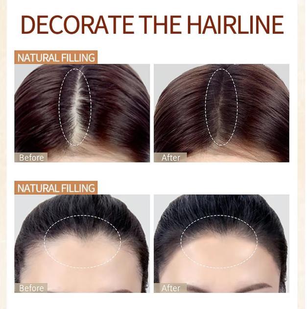 Hairline Powder Root Touch-Up – Instantly Covers Thinning Areas and Conceals Hair Loss, Creates a Natural, Fuller Hairline in Seconds Hairline Powder Root Touch-Up – Instantly Covers Thinning Areas and Conceals Hair Loss, Creates a Natural, Fuller Hairline in Seconds