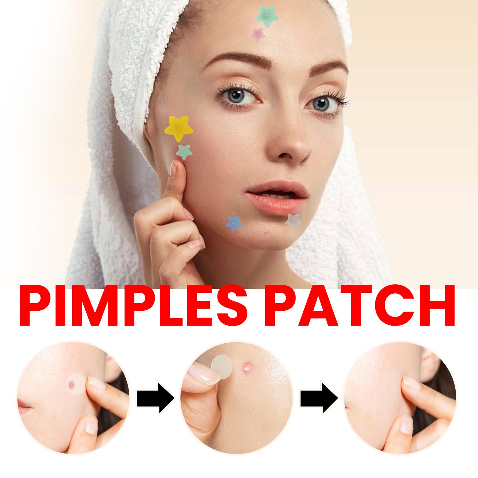 Jaysuing Gentle Acne Pore Cleansing Cover Patches 200pcs Colorful Hydrocolloid Stickers with Tea Tree and Witch Hazel for Blemish Care and Oil Control