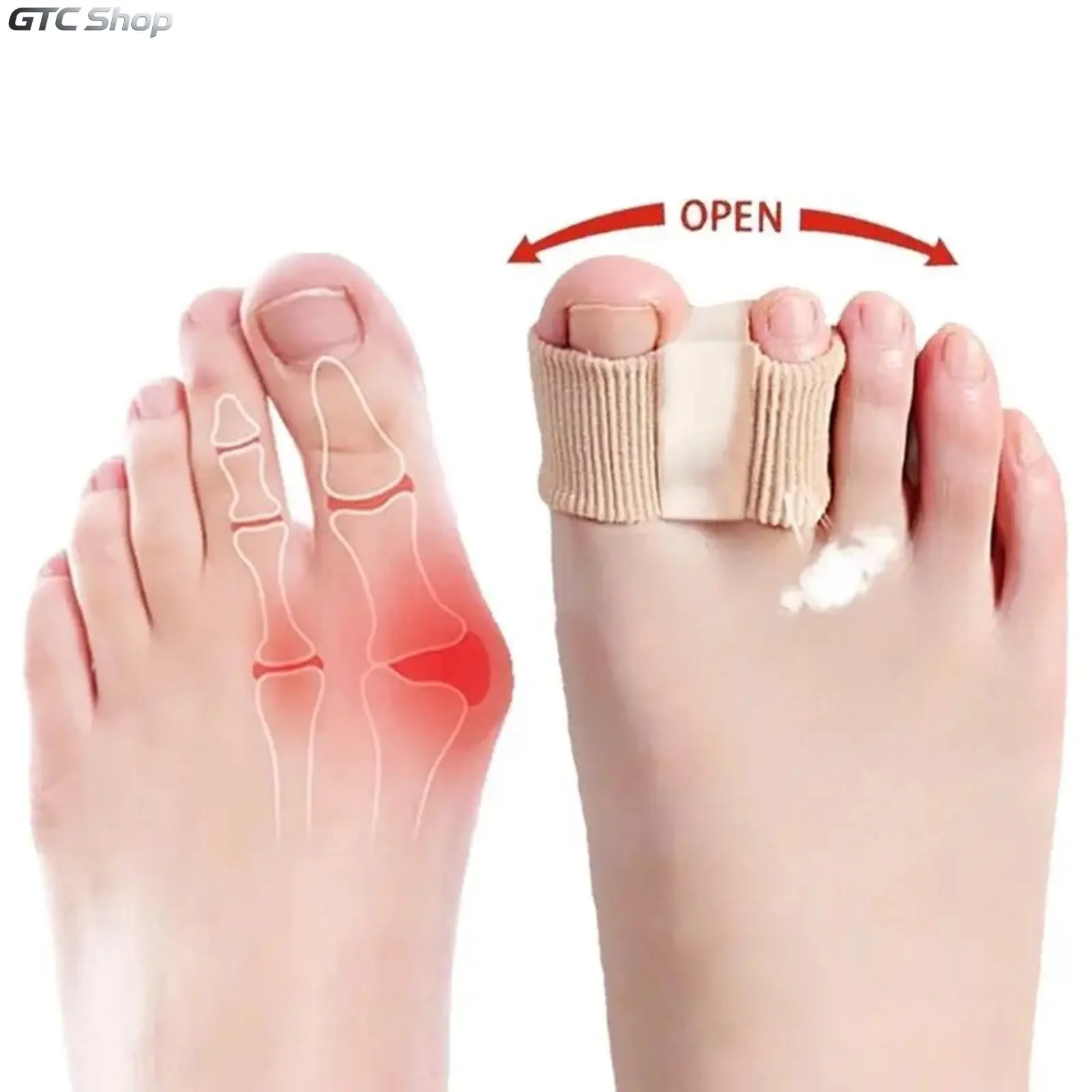 Silicone Toe Separators for Bunion Relief -springtok , All-DayComfort for Walking, Running, Hiking | Bunion Corrector &Toe Sleeves Healthcare