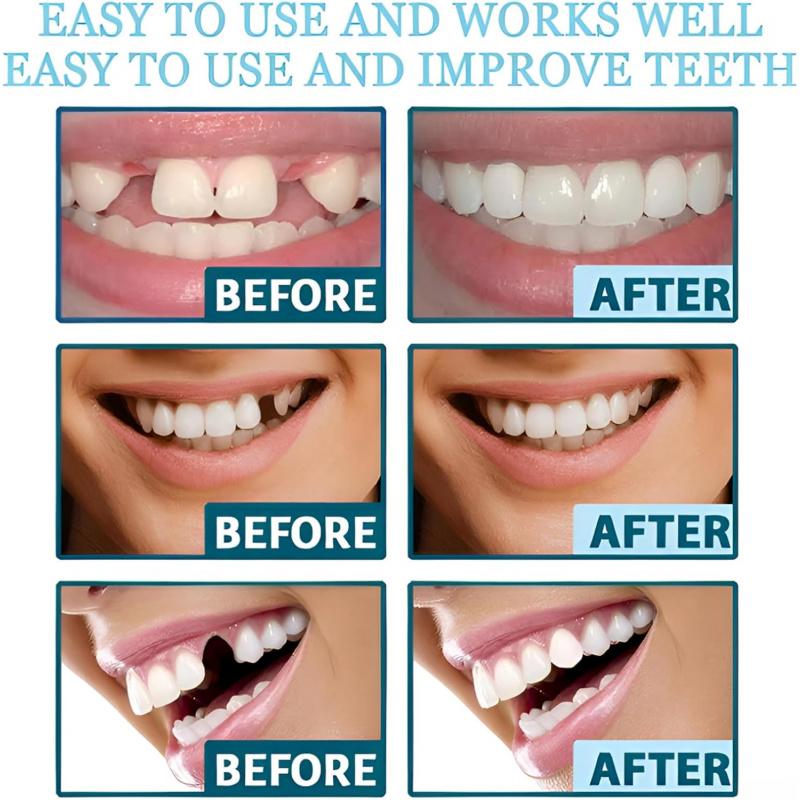 6 smile supports to restore a confident smile, suitable for adults, come with a round storage box and outer packaging.