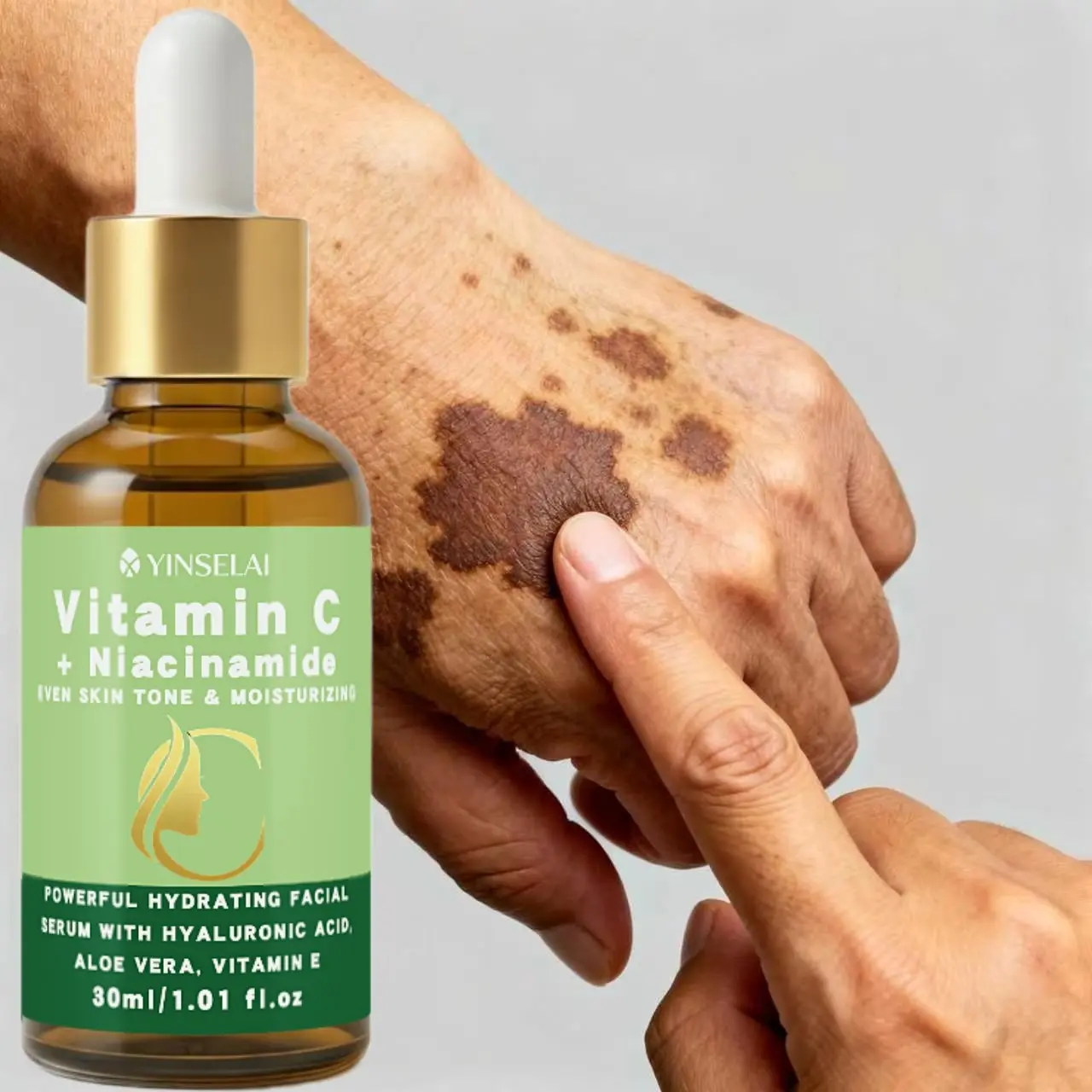 Dark Spot Corrector Serum – Vitamin C & Niacinamide, Fade Pigmentation with Aloe & Vit E 30ml