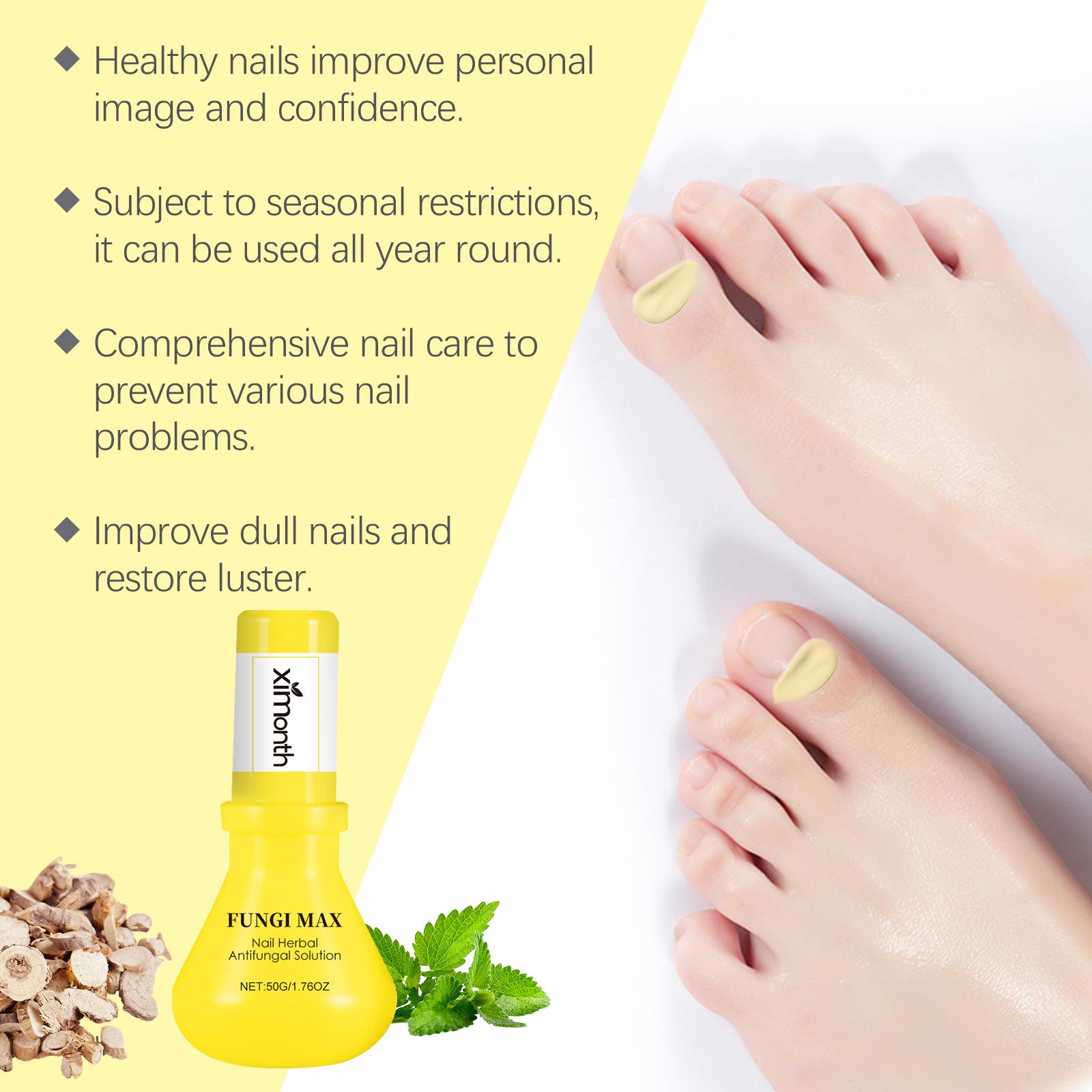 Ximonth Herbal Nail Care Solution Hand, Foot And Nail Cleansing And Repair Bright Nail Thick Toe Care Solution