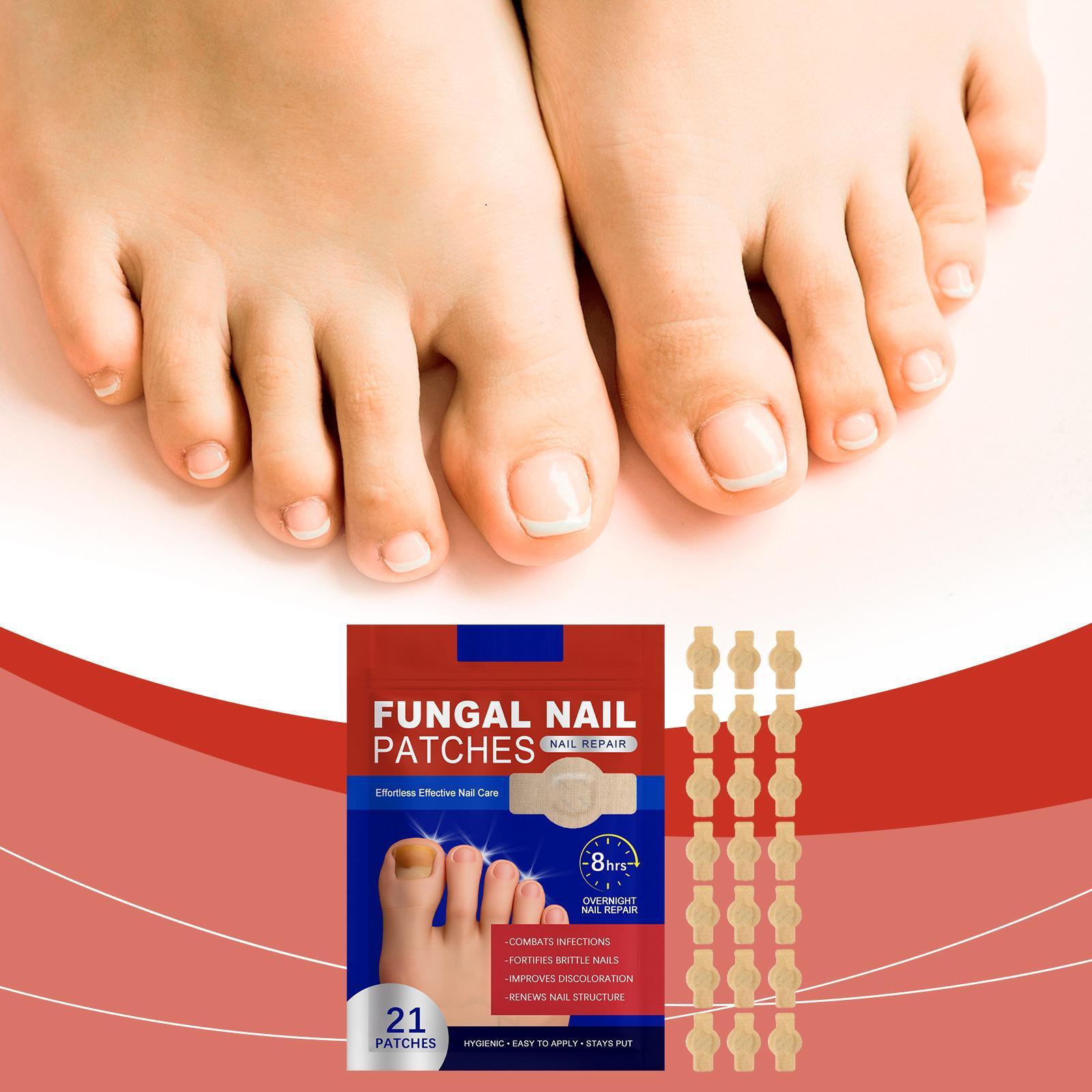 Fungal Nail Patches, 21pcs/box Nail Health Care Patches, Effective Solution for Fungal Nails & Nail Problems, Daily Nail Care Kit
