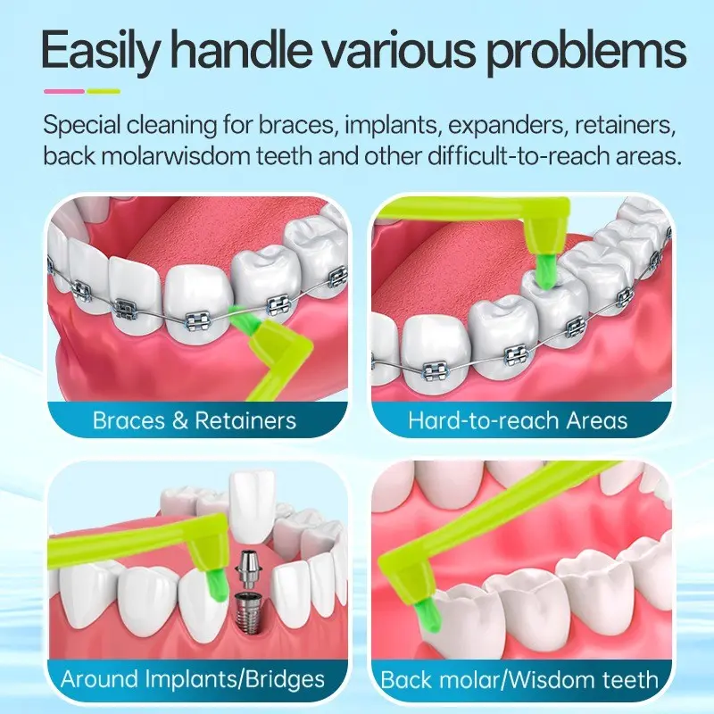 Oral Care】End-tuft Toothbrush – Replaceable Brush Heads, 6 Brush Heads Included, Soft & Dense Bristles. Specially Designed for Orthodontic Appliances to Precisely Clean Hard-to-Reach Areas and Protect the Health of Teeth and Gums