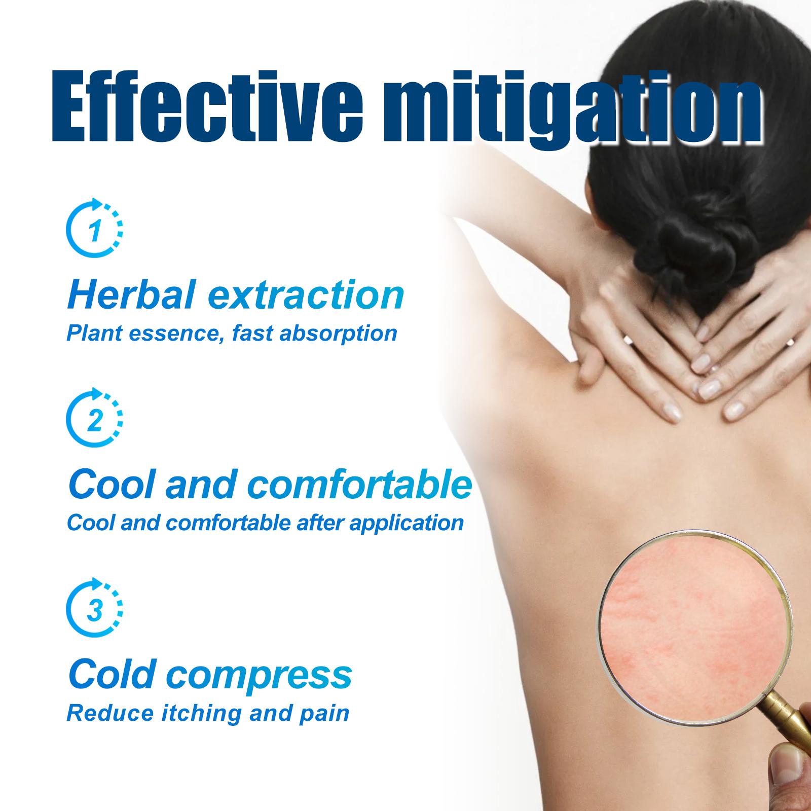 South Moon Urticaria Cream, Topical Ointment For Relieving Pruritus Redness And Repairing Skin