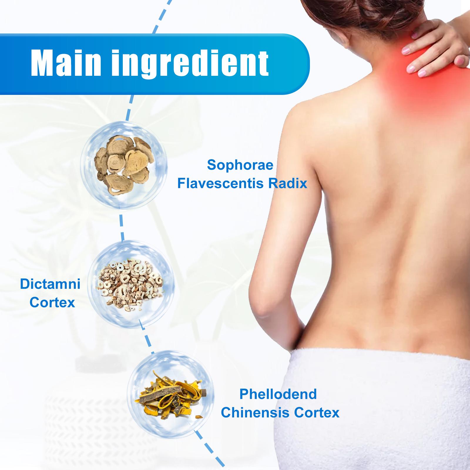 South Moon Urticaria Cream, Topical Ointment For Relieving Pruritus Redness And Repairing Skin