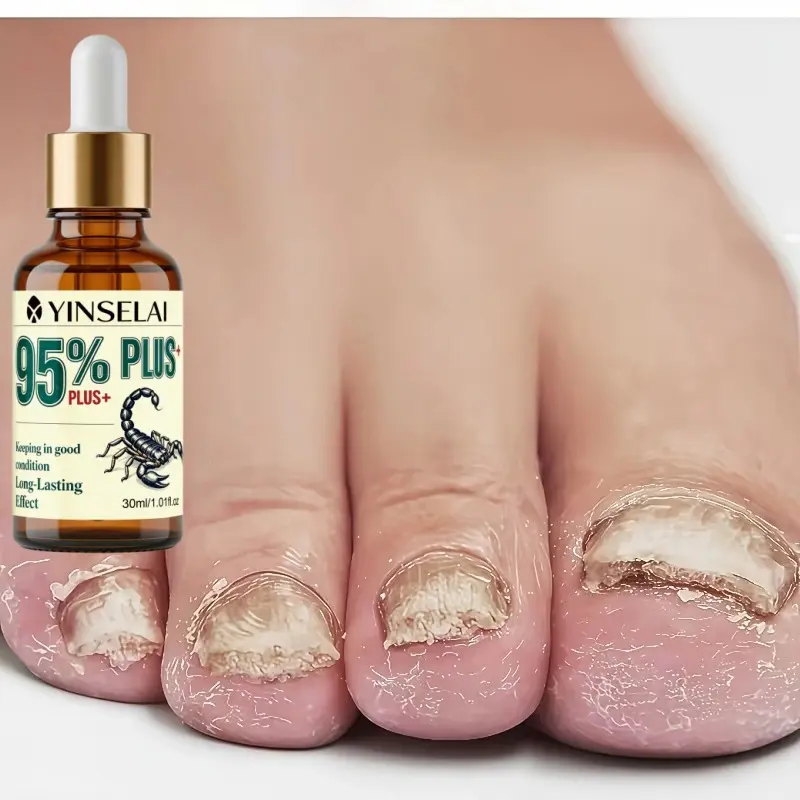 Nail Care Essence Liquid, Nail Hardener, Strengthening Coating, Crack Repair, Nail Protection, Protective Manicure, Nail Enhancement