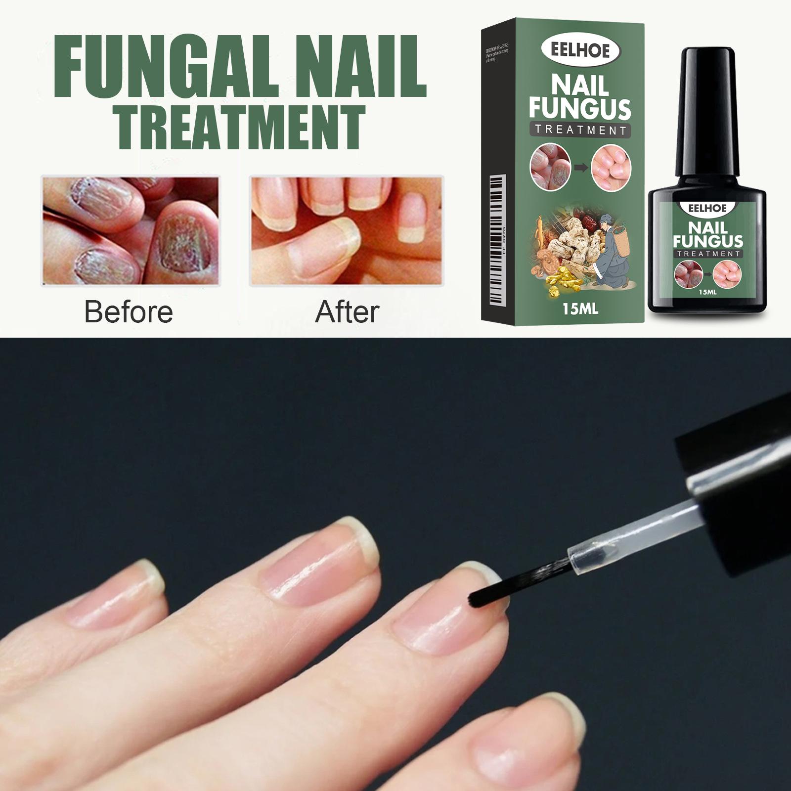 Nail Growth Oil - 100% Organic, Moisturizing, Growth, Strengthening, and Brightening Formula with Vitamins and Fatty Acids for Overall Nail Health