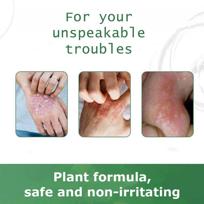 SanNuo Herbal Antibacterial Soothing Cream – Relieves Eczema, Psoriasis & Itching, Safe for Dry & Sensitive Skin, Zero Hormone & Fragrance-Free Creme for Eczema