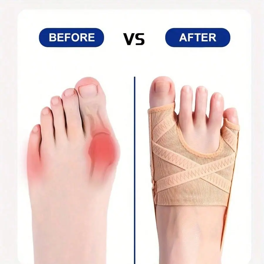 1 Pc Bunion Corrector, Adjustable Big Toe And Tail Toe Separator Bunion Splint Brace, Bunion Socks Wear With Shoes Splint Sleeve Spacer Separator Hammer Toe Corrector For Left And Right Foots