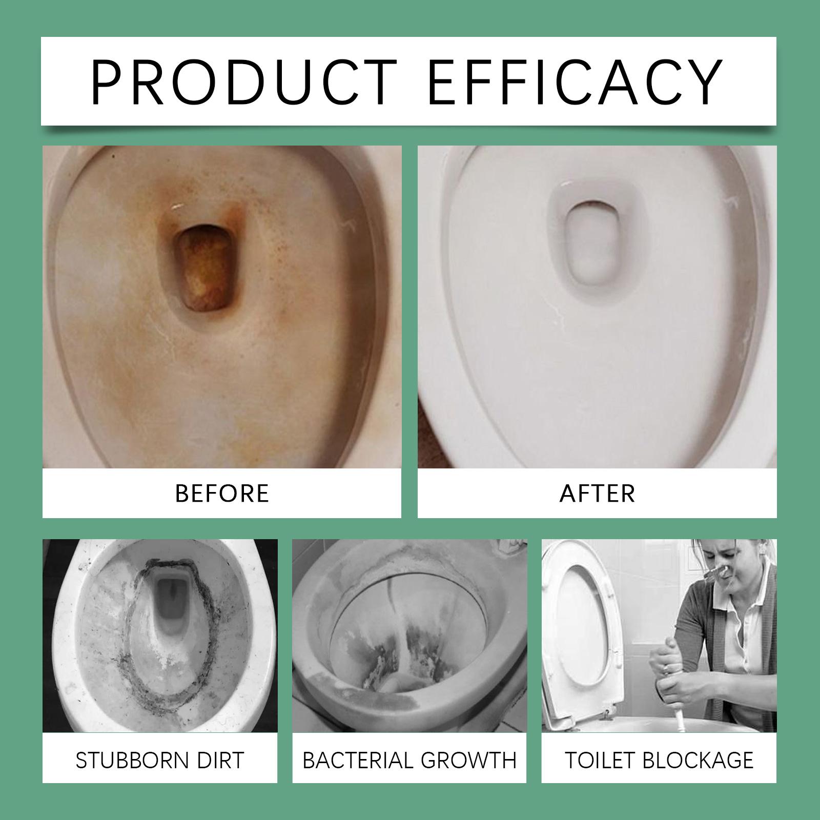 Oxalic Acid Toilet Cleaner – Removes Stains, Urine Scale & Dirt Cleaner