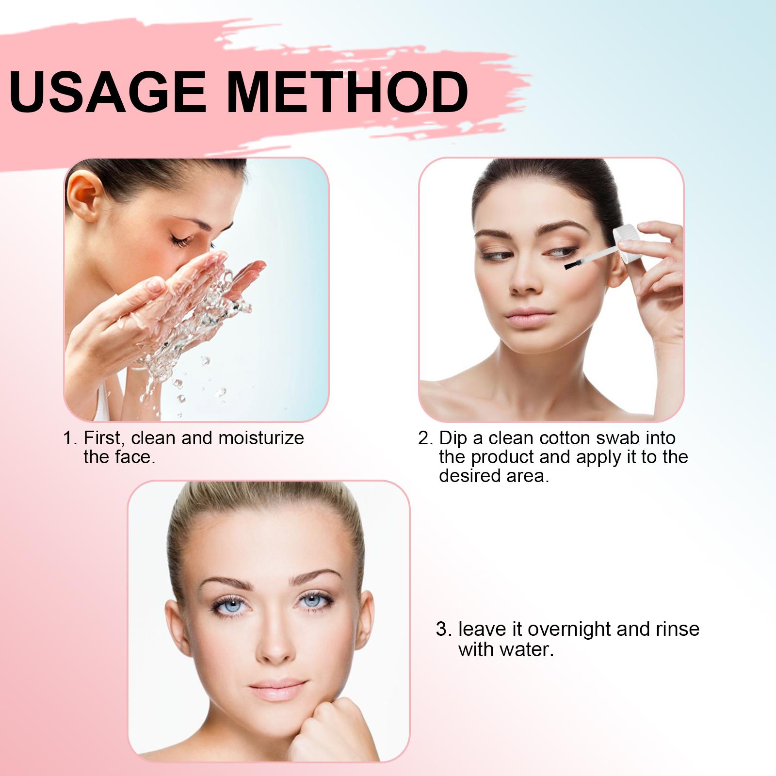 Acne Lotion, 1 Box Pink Deep Cleansing Acid Lotion for Acne, Moisturizing Acne Care Lotion, Face Skin Care Product for Women & Men