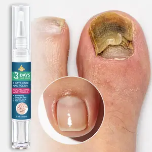 SUMIEANG | Keratin Amino Acid Nail Polish | Salicylic Acid + Collagen + Vitamin C | • Moisturizes & Protects Nails • Effortlessly Adds Shine • Brightens Nail Surface | For Dry/Brittle Nails | Ideal for Daily & Professional Use