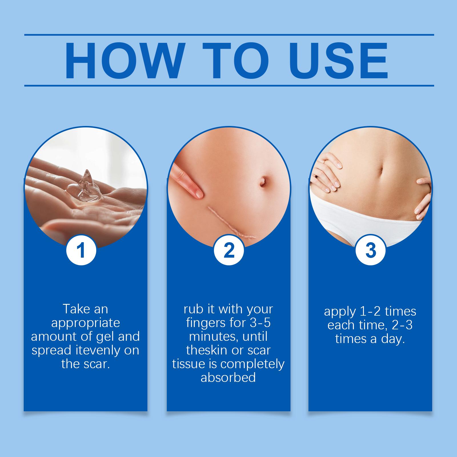 Advanced Silicone Scar Cream - Improves Appearance of Scars, Smooths & Hydrates Skin, Gentle Formula for Old & New Scars 30g