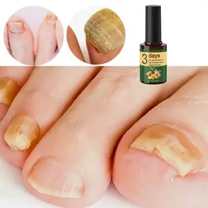 Ginger Nail Care Product, Ginger Cuticle Oil for Nail Maintenance, Cuticle Essence for Healthy Nails, Comfortable Manicure