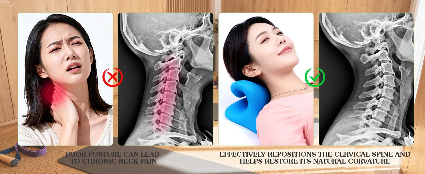 Neck Stretcher Cervical Traction Pillow with Acupressure, Neck and Shoulder Relaxer for TMJ Pain Relief, C-Arch Chiropractic Pillow, Spine and Neck Corrector