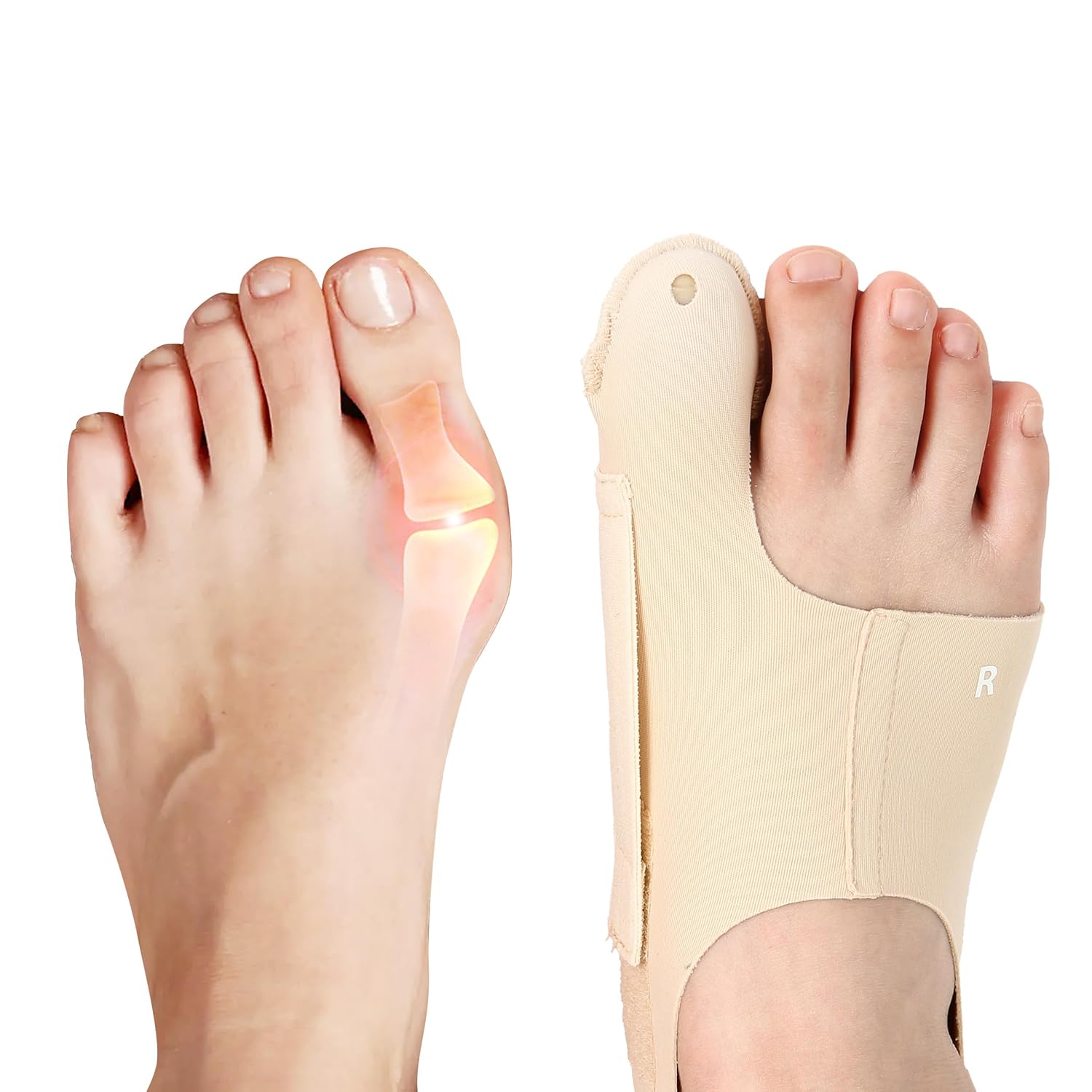 Adjustable Bunion Corrector for Big Toe Alignment, Wear-in-Shoes Pain Relief Brace