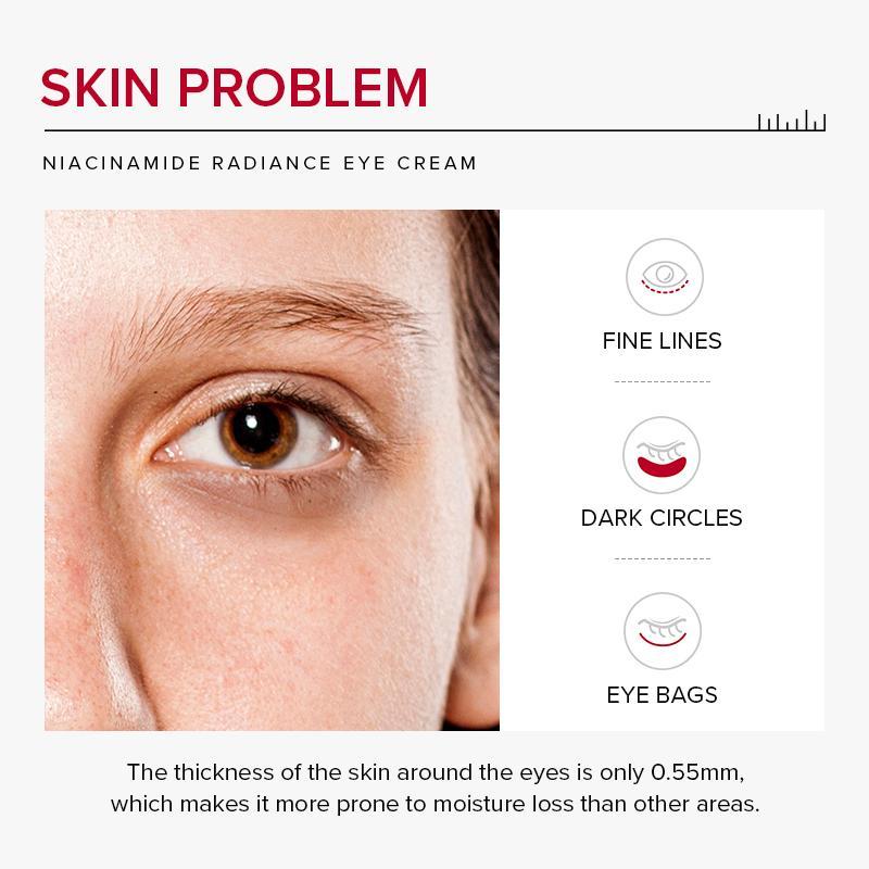 Firming Eye Creams, Niacinamide Radiant Eye Cream, Moisturizing Eye Creams, for Reducing The Look Of Age Spots, Valentine's Day Gift