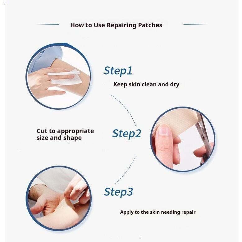 Silicone Scar Repair Patches, 3 Sheets – Fades Acne/Post-Surgery Scars | Stops Itching & Softens Hypertrophic Scars