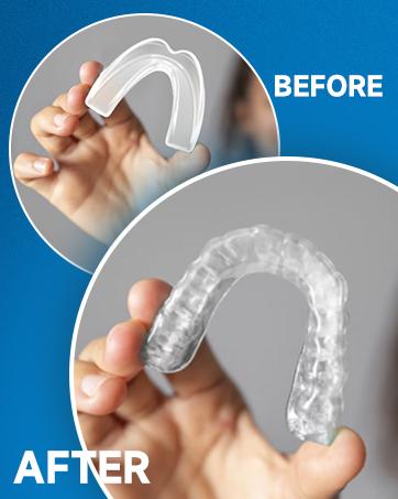 GBN Mouth Guard for Grinding Teeth at Night - Custom Fit Night Guards - Comfortable Mouth Guard for Sleeping, Nightguard, Mouthguard Includes 2 Sizes, 12 Cleaning Tablets