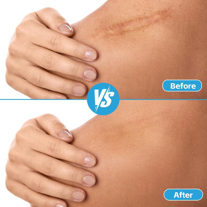 Hydrocolloid Bandages For Care  Extra Large Medical-grade Roll With Self-adhesive Ultra Absorbent Flexible & Waterproof Diy Size Shape First Aid Kit (2in*16ft)