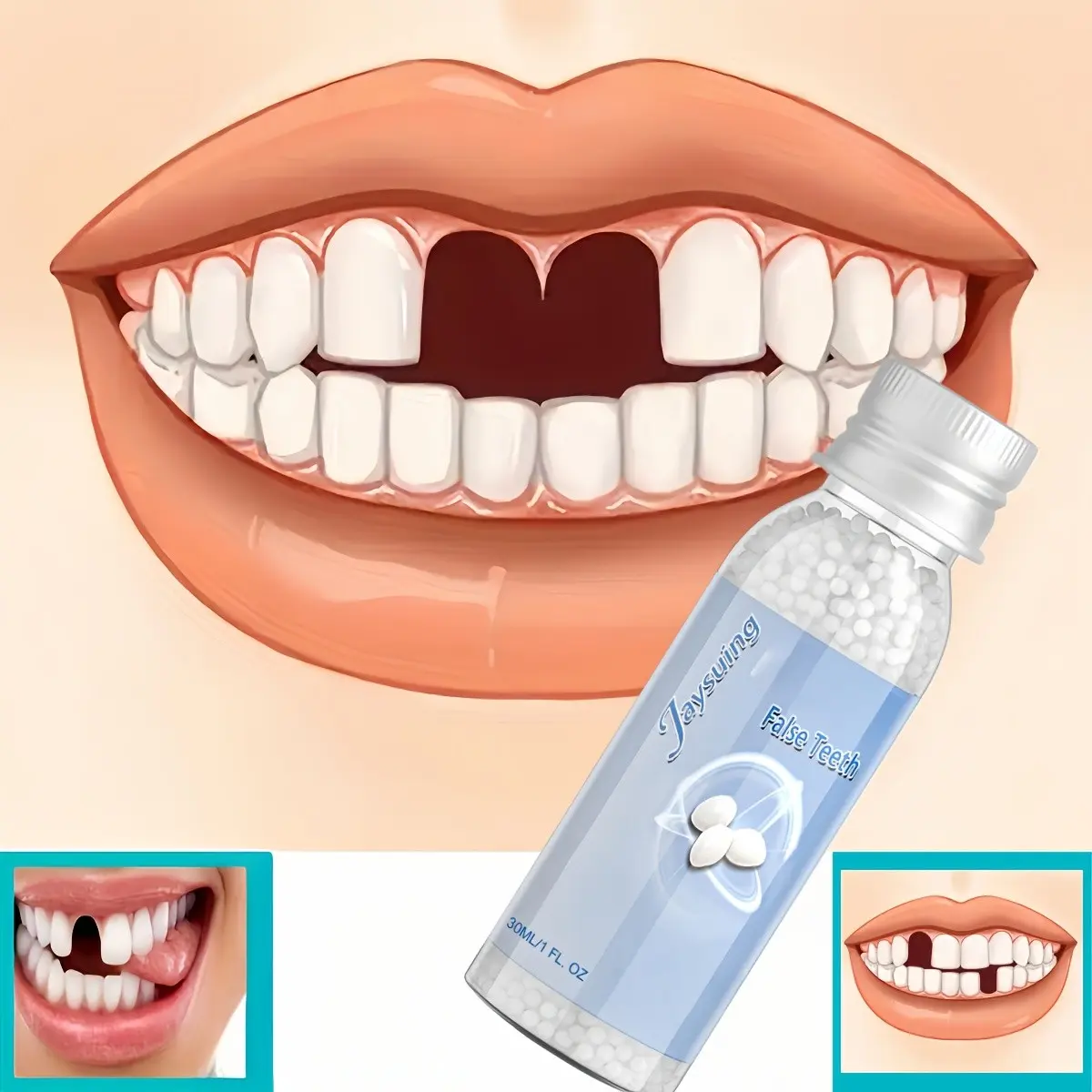 Cosmetic Teeth Veneers-False Teeth Realistic False Teeth for Missing Teeth, Broken Teeth, Large Teeth Gaps, Decorative, Adjustable, Easy to Use, Suitable for Men And Women, Elderly, Seamless Fit, Durable Material, Teeth Replacement