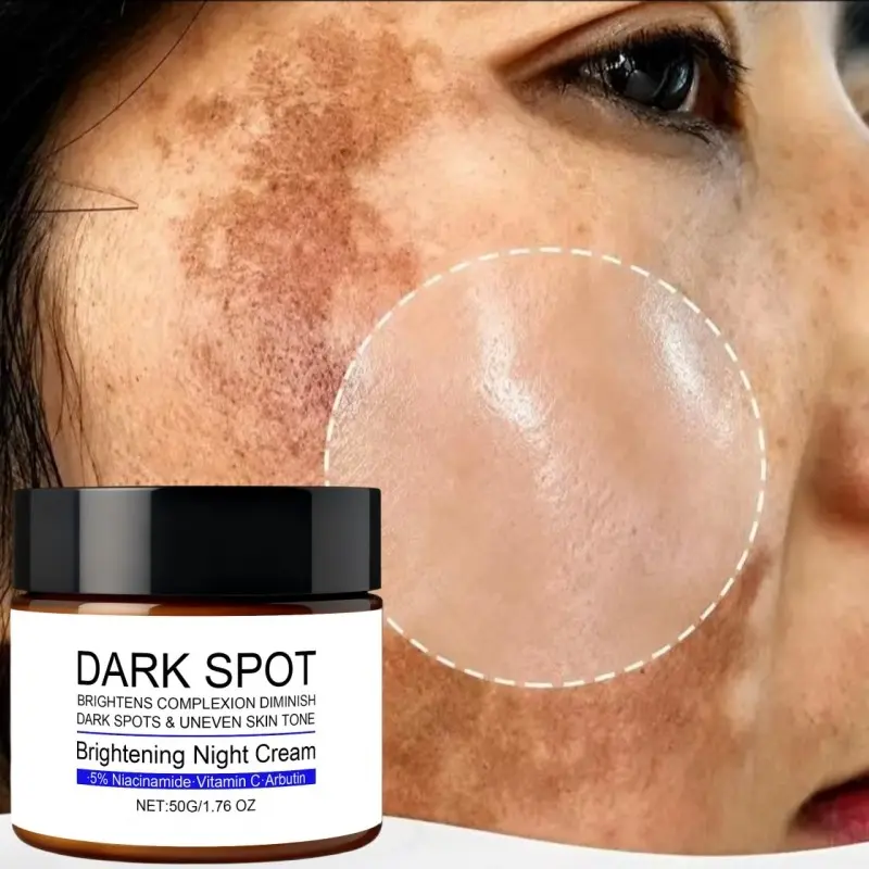 Hyperpigmentation Melasma Spot Remover  Dark Spot Corrector Cream for Face Body, Niacinamide + Alpha‑Arbutin, Fade Freckles Sun & Age Spots, Lightweight Non‑Greasy Skincare, Brightens Skin