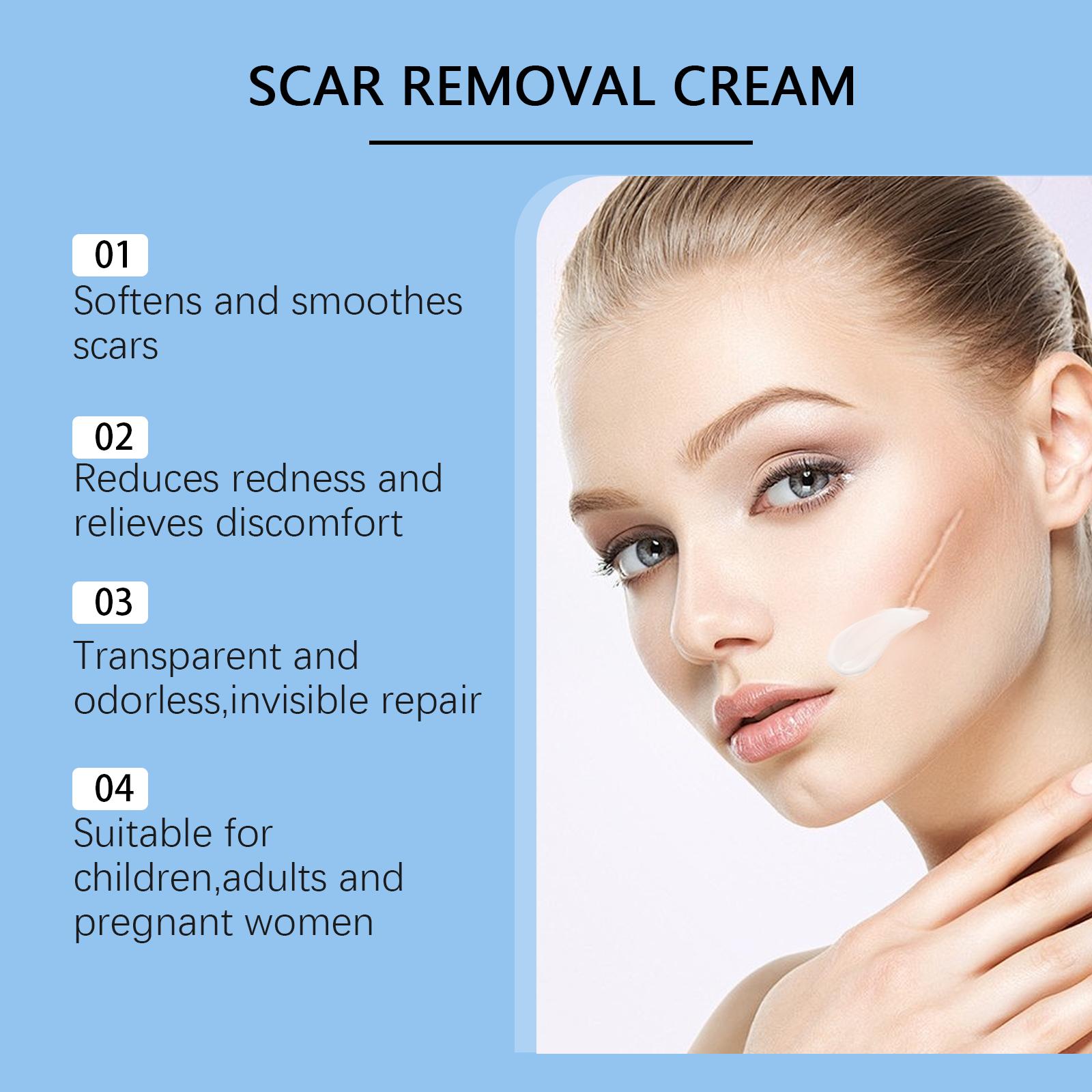 Advanced Silicone Scar Cream - Improves Appearance of Scars, Smooths & Hydrates Skin, Gentle Formula for Old & New Scars 30g