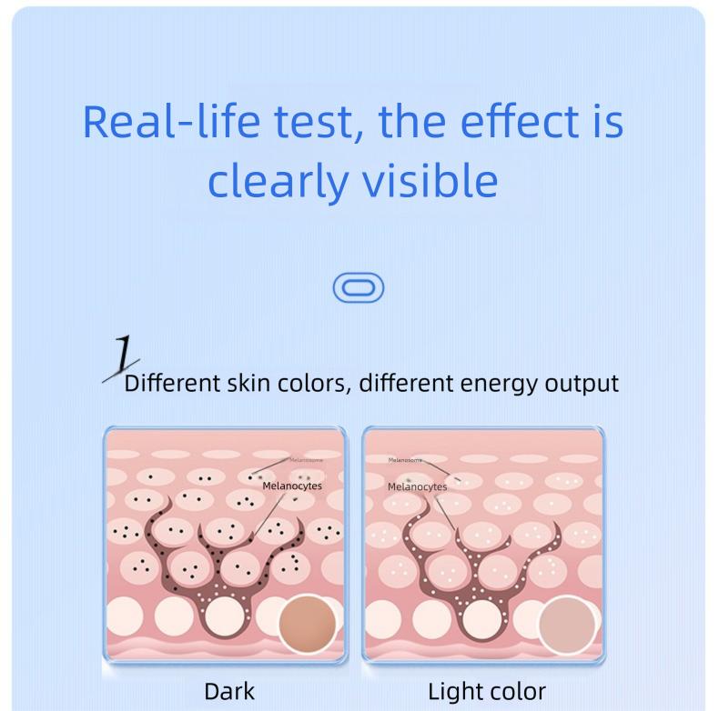 IPL Laser Hair Removal Device with Sapphire Ice-Cooling Technology for Women & Men, Painless & Long-Lasting Hair Remover for Full Body Use at Home, Safe on Face, Bikini Line, Armpits