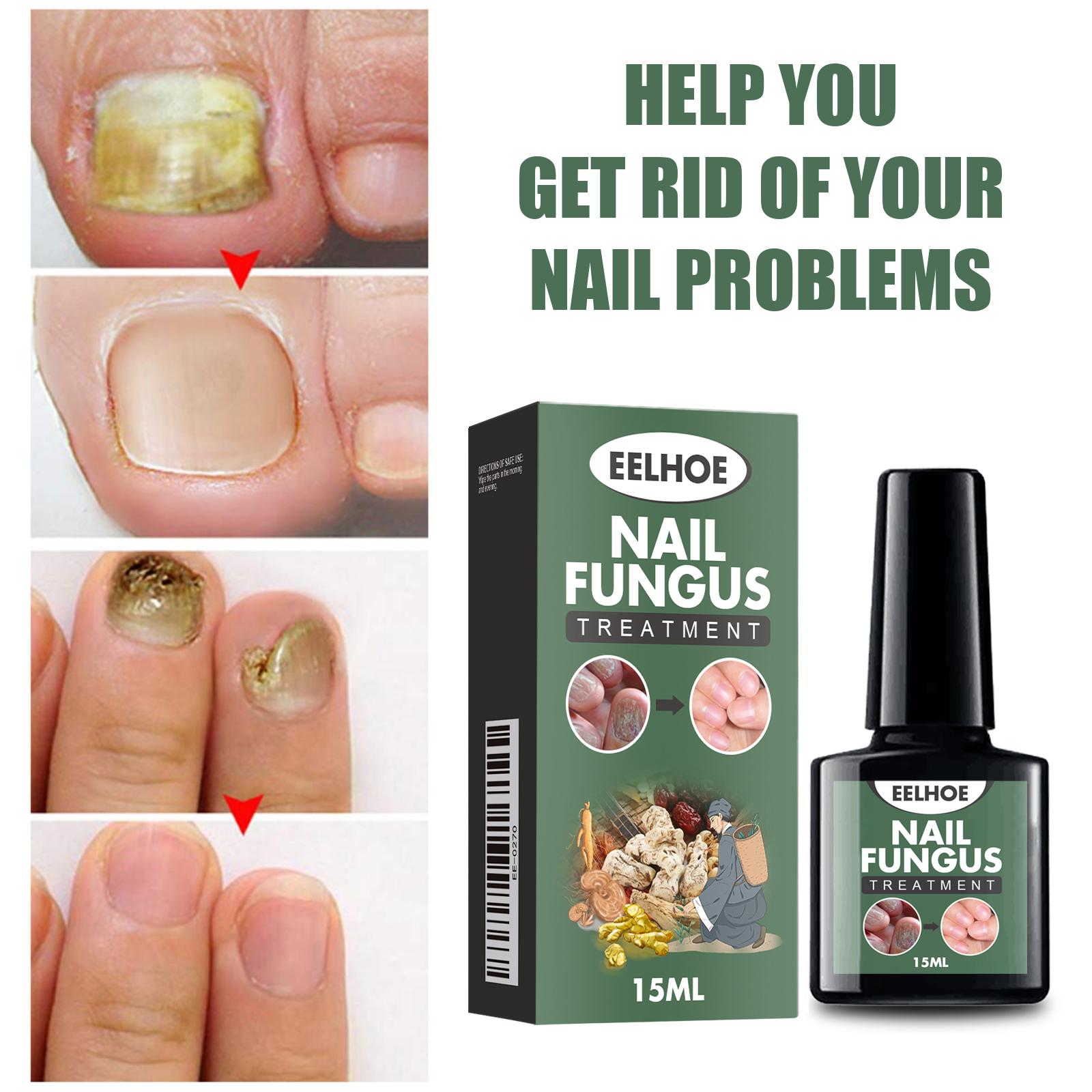Nail Growth Oil - 100% Organic, Moisturizing, Growth, Strengthening, and Brightening Formula with Vitamins and Fatty Acids for Overall Nail Health