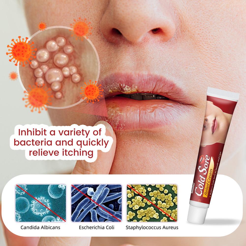 Sumifun Ointment Lip Rash Care Cream Lip Perimeter Skin Cream Skincare Comfort lip balm Lipbalm