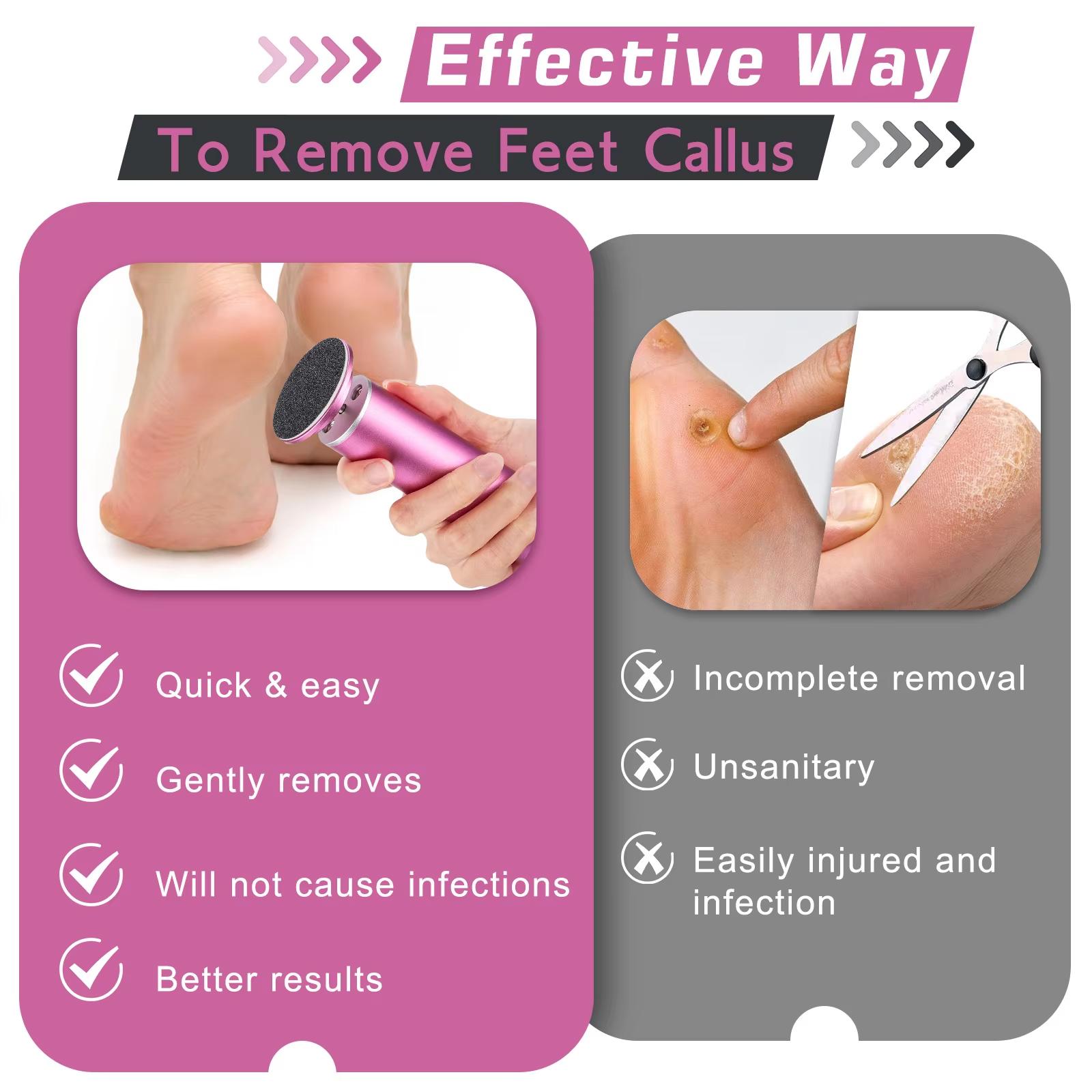 Electric Foot File, 1 Count Adjustable Speed Foot Callus Remover with 60pcs Sandpaper, Exfoliating Callus Remover, Professional Foot Care Tool, Pedicure Care Tool for Home & Salon Use, Callus Remover Feet, Foot Files And Callus Removers For Dead Skin
