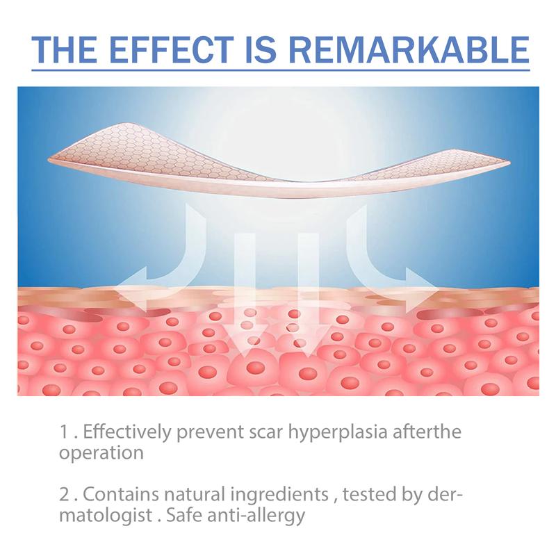 South Moon High Quality Silicone Scar Sheets, Fade Scar Waterproof Breathable Skin Scar Beauty Patch