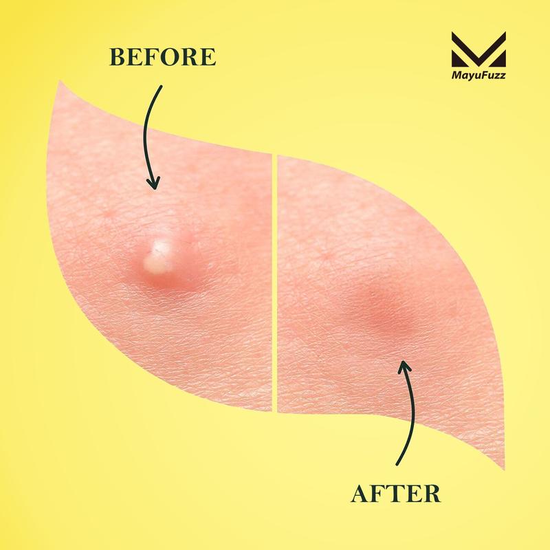 Acne Patches for Blemish Cover, Invisible Spot Care Stickers for Clear Skin, Daily Skincare Pimple Patches for Effective Care